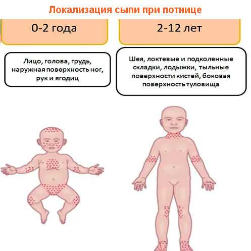 Волосы на ушах новорожденного | уроки для мам