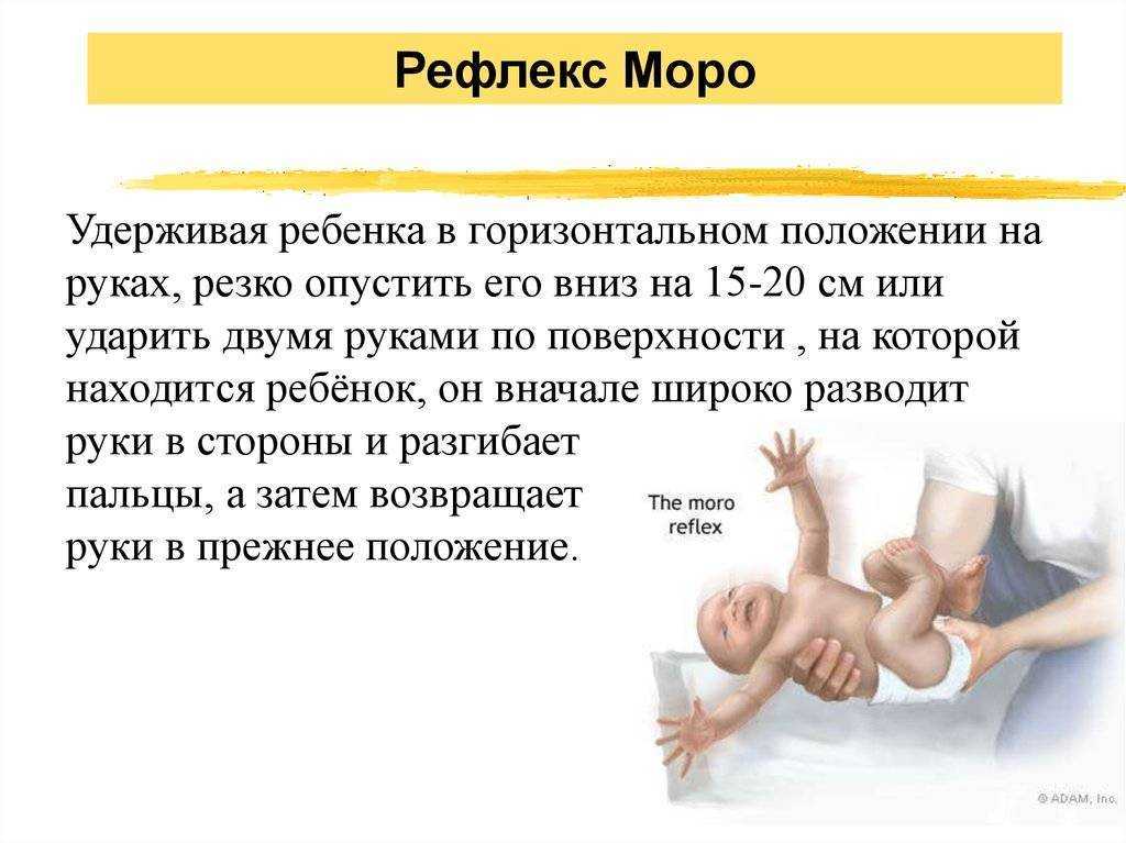Безусловные рефлексы новорожденного