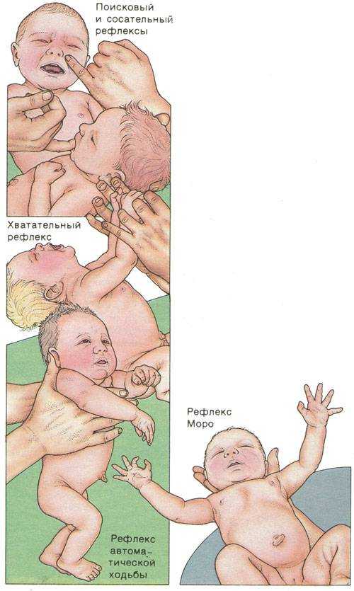 Слабые рефлексы. Рефлексы новорожденных. Сосательный рефлекс новорожденного. Массаж для развития сосательного рефлекса. Развитие сосательного рефлекса у новорожденных.