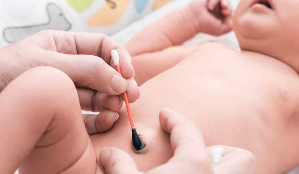 Решаем проблему: что делать, если у новорожденного кровит пупок